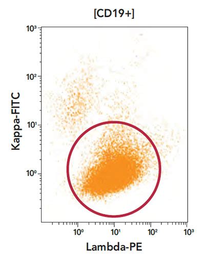Leukemia and Lymphoma: How Flow Cytometry Aids Diagnosis.